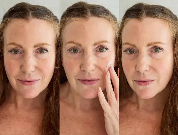 How to Build Your Skincare Routine: Ultimate Dermatologist Recommended Tips 5 Addressing Specific Skin Concerns After 40