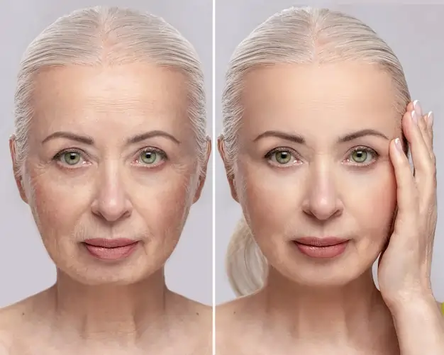 How to Build Your Skincare Routine: Ultimate Dermatologist Recommended Tips 2 Understanding Skin Changes in Your 40s
