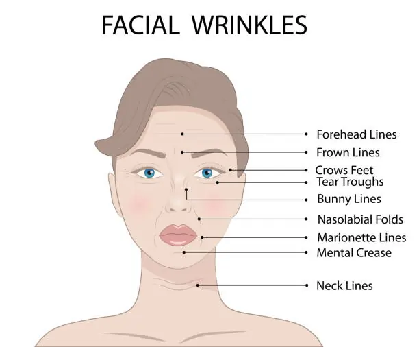 How to Get Rid of Wrinkles Naturally: 7-Day Skincare Guide That Works 2 Understanding Wrinkles: Types and Causes