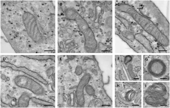 What Are The Functions of Mitochondria: A Shocking Age Predictor 3 a collage of images of cells