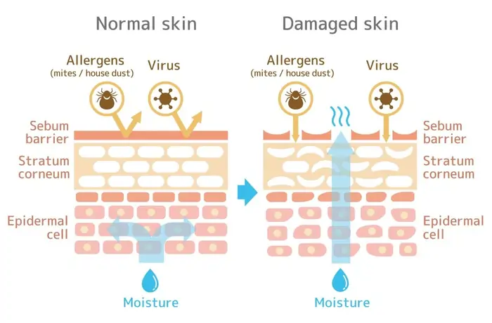 How to Repair Damaged Skin Barrier: An Expert-Backed Guide That Actually Works 4 What causes skin barrier damage?