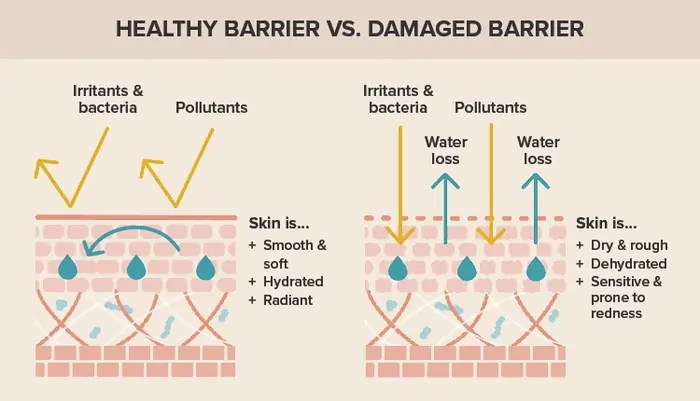 How to Repair Damaged Skin Barrier: An Expert-Backed Guide That Actually Works 5 How to Start Repairing Your Skin Barrier