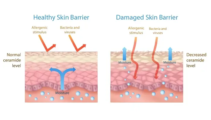 How to Repair Damaged Skin Barrier: An Expert-Backed Guide That Actually Works 3 Common Signs of a Damaged Skin Barrier